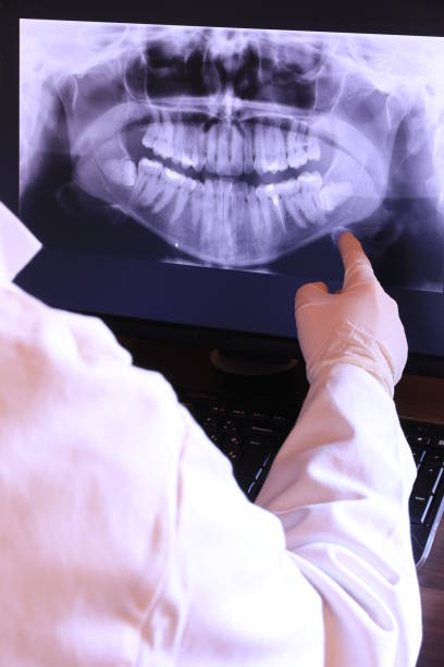 Best Emergency Broken Tooth Repair in Wilkesboro, NC