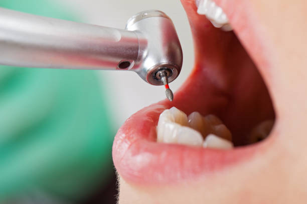 Best Emergency Treatment for Toothache in Wilkesboro, NC